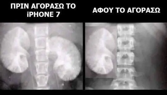 ΠΡΙΝ TO iPHONE ΑΦΟΥ ΤΟ ΑΓΟΡΑΣΩ